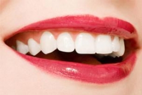 Speciale Promo: SBIANCAMENTO DENTI PROFESSIONALE - EXTRASTRONG - Dentista Milano Rizza s.r.l.