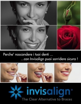 Sorrisi Straordinari grazie agli Allineatori Invisibili - Dentista Milano Rizza s.r.l.